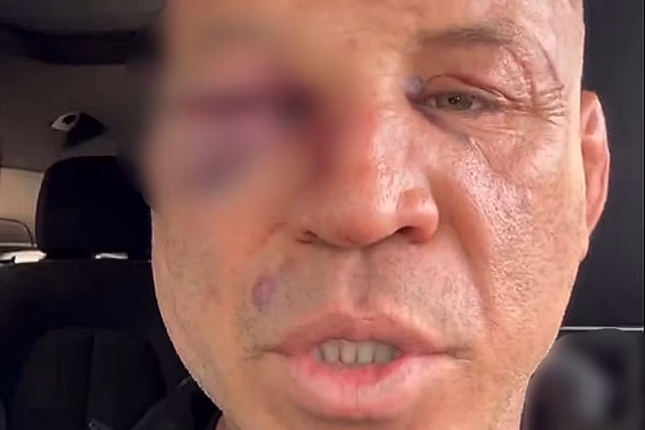 Após surra e internação, Wanderlei Silva grava vídeo e diz que fará novos exames pois sente dor de cabeça